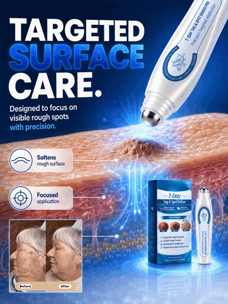 ✨ Painless & Precise Wart Removal ✨ 🖊️ Skin Repair Pen with Easy Roll-On Application 👩‍🦰👨‍🦱 Suitable for Both Men & Women 🎯 Precise Targeting | 🌿 Gentle Skin Care | ✅ Proven Effective!