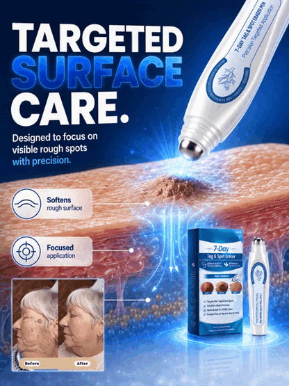 ✨ Painless & Precise Wart Removal ✨ 🖊️ Skin Repair Pen with Easy Roll-On Application 👩‍🦰👨‍🦱 Suitable for Both Men & Women 🎯 Precise Targeting | 🌿 Gentle Skin Care | ✅ Proven Effective!