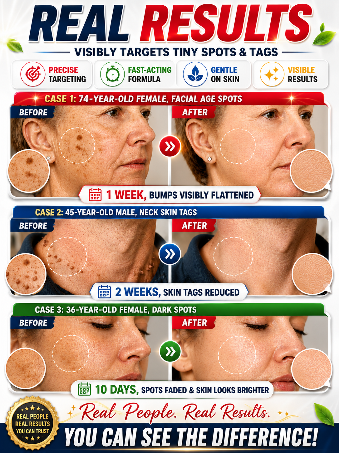 ✨ Painless & Precise Wart Removal ✨ 🖊️ Skin Repair Pen with Easy Roll-On Application 👩‍🦰👨‍🦱 Suitable for Both Men & Women 🎯 Precise Targeting | 🌿 Gentle Skin Care | ✅ Proven Effective!